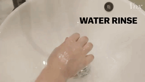 感应式手部消毒器